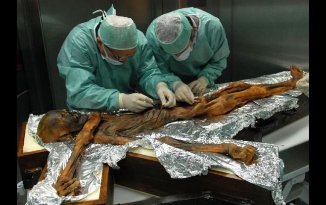 La momia de Otzi ha sido objeto de todo tipo de estudios. Los expertos no habían podido realizar antes análisis porque, en un principio, habían sido incapaces de encontrar el estómago. EFE/Museo de Arqueología del Tirol del Sur/ARCHIVO