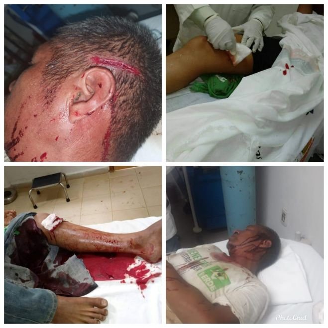 Tres lesionados en Aldama por ataques de grupos armados de Chenalhó