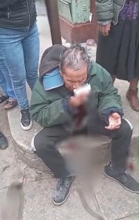 Adulto mayor es agredido en vía pública 