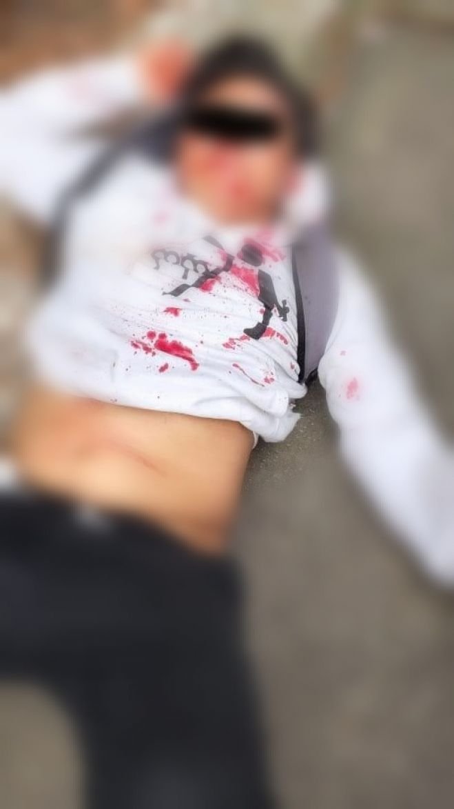 Joven pierde la vida al derrapar en su motocicleta