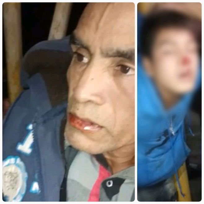 Retienen y golpean a padre e hijo en Mitontic