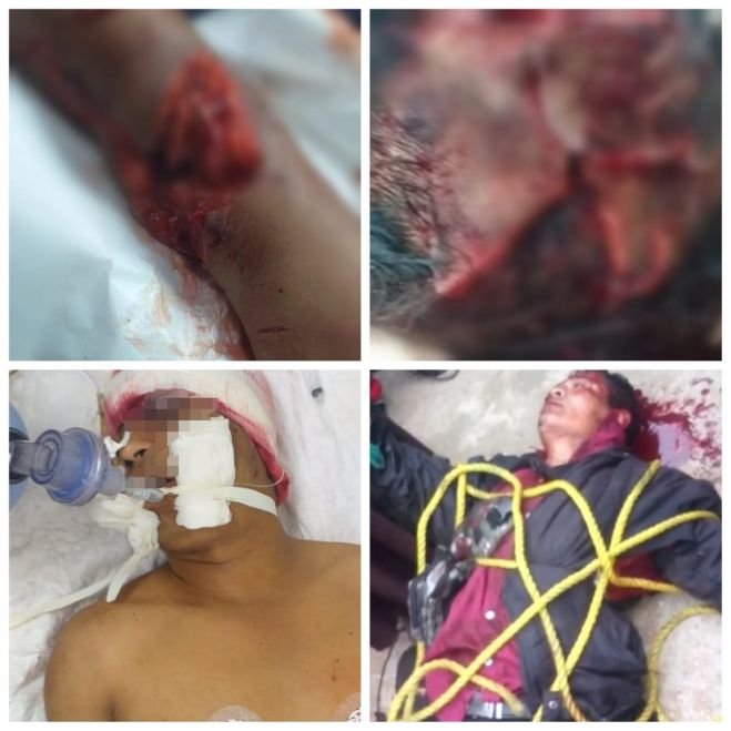 Chanal se agarran a machetazos