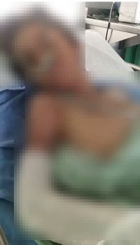 Alumno resulta lesionado en escuela; lleva 13 d&iacute;as hospitalizado