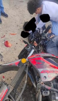 Motociclista resulta gravemente herid&ouml; tras accidente vial