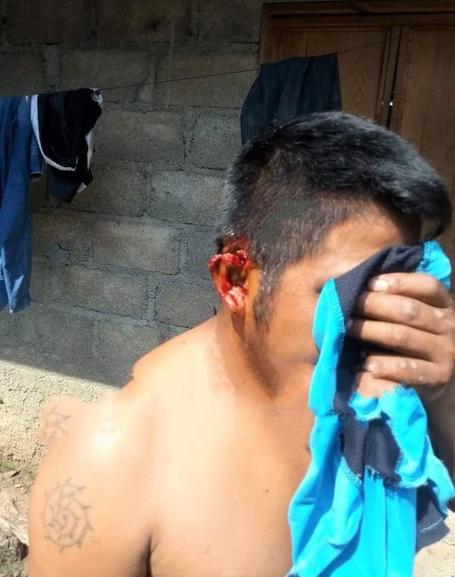 Enfrentamiento deja dos lesionados en Ocosingo