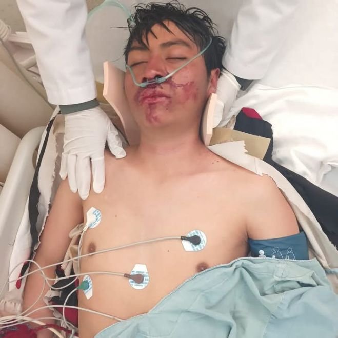 Joven resulta gravemente herido en el último día del Carnaval de San Juan Chamula