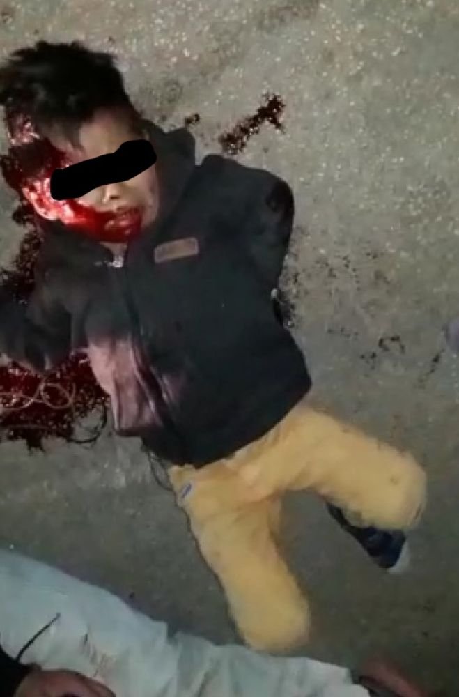 Atropellan a menor de edad en la zona norte