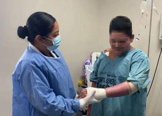 Logran recuperación con injertos in vitro de adolescente con quemaduras